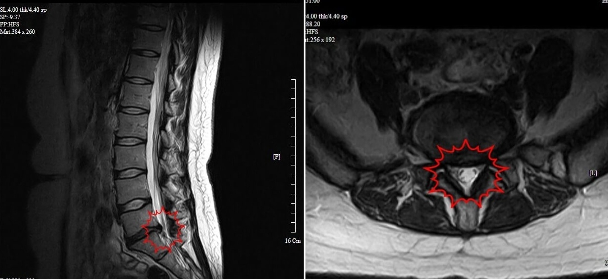 KyungOO-MRI-tile