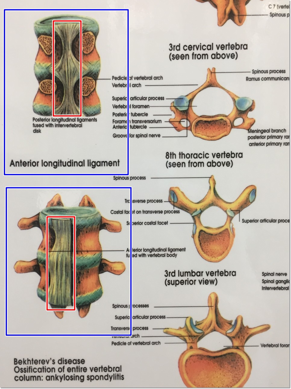 척추 구조 판넬 2