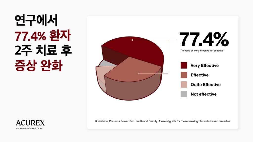 효과적인 태반약침